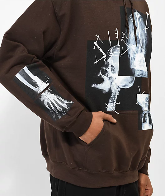 17682-sus-boy-x-ray-dark-brown-hoodie-4.webp SUS BOY X-Ray Dark Brown Hoodie